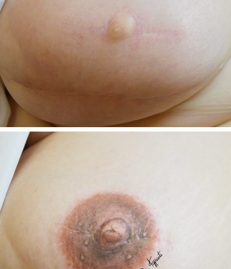 ΔΩΡΑ ΚΥΠΡΙΩΤΗ - Ιατρικό Μόνιμο Μακιγιάζ