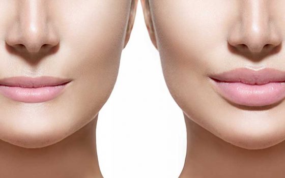 hyaluronic-pen hyaluronic-pen